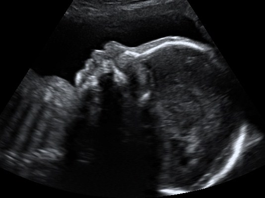 Ultrasound Profile Picture 
